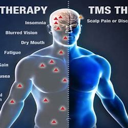 TMS Center of Chappaqua New York - Drug Therapy v/s TMS Therapy