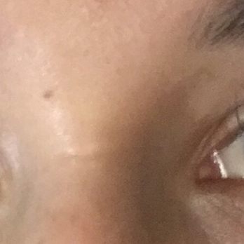 I Love Lash - 13 days after - Eyelash Service Near Me - Fort Lee, New Jersey I Love Lash - 13 days after - Eyelash Service Near Me - Fort Lee, New Jersey