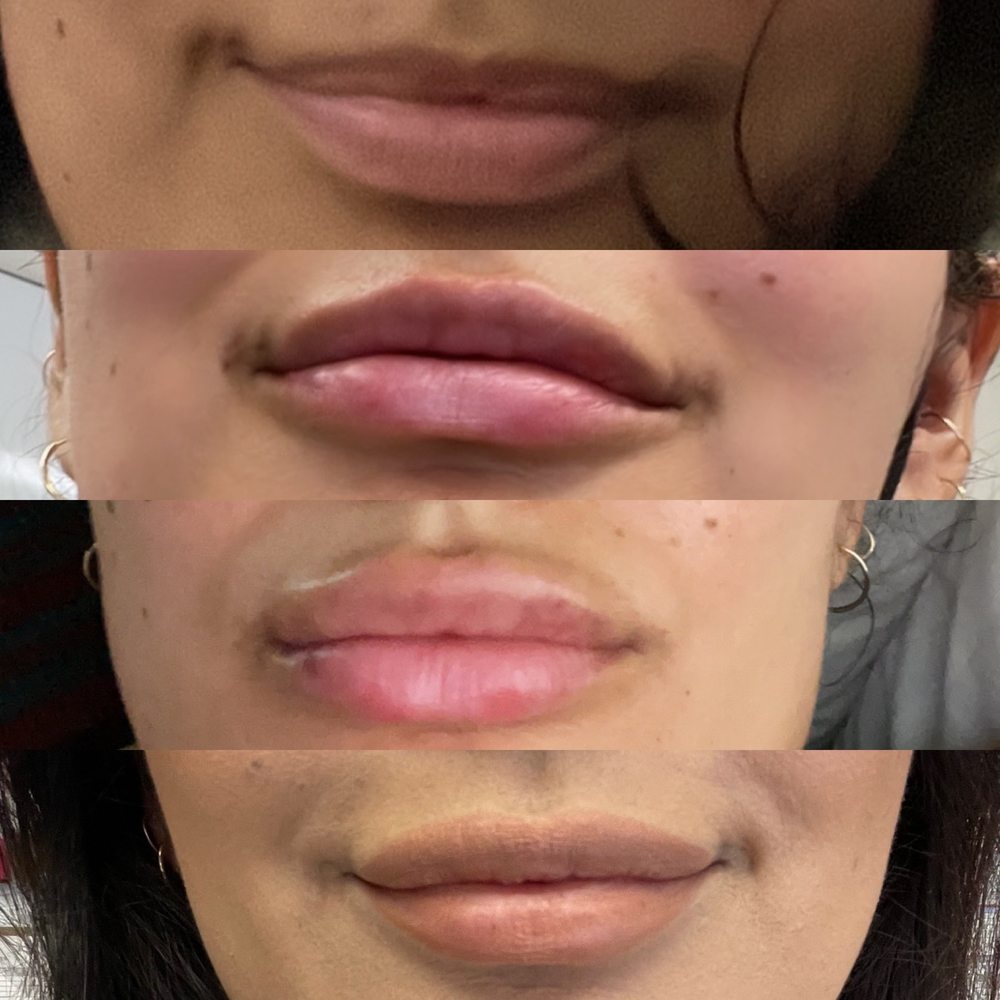 TOP 10 BEST Plastic Surgeon Tummy Tuck in Manteca, CA - Updated 2025 - Yelp