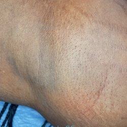 Beauty by Brooke 25 - After underarm wax