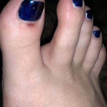 Relax Foot Spa - My cut cuticle - Massage Near Me - Raleigh, North Carolina Relax Foot Spa - My cut cuticle - Massage Near Me - Raleigh, North Carolina
