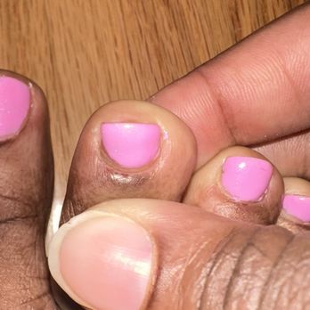 Urban Nails Bar - Proof of the cuts on 2 toes during my cuticle trim. They're both extremely sore, they throb and are uncomfortable in socks. - Nail Salons Near Me - Charlotte, North Carolina Urban Nails Bar - Proof of the cuts on 2 toes during my cuticle trim. They're both extremely sore, they throb and are uncomfortable in socks. - Nail Salons Near Me - Charlotte, North Carolina