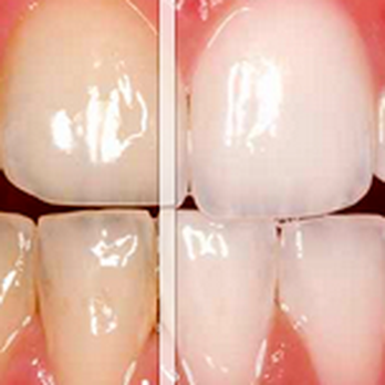 Keith Bracy, DDS - Cosmetic Dentists Near Me - New York, New York