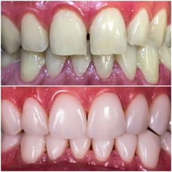 SmileOn Dentistry
