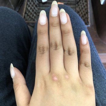 Artistic Nails and Spa - SNS on split pointer fingernail and thumb. Rest are just gel from over a week ago. Gel- Hannah. SNS fix- Vivian. - Nail Salons Near Me - Vienna, Virginia Artistic Nails and Spa - SNS on split pointer fingernail and thumb. Rest are just gel from over a week ago. Gel- Hannah. SNS fix- Vivian. - Nail Salons Near Me - Vienna, Virginia