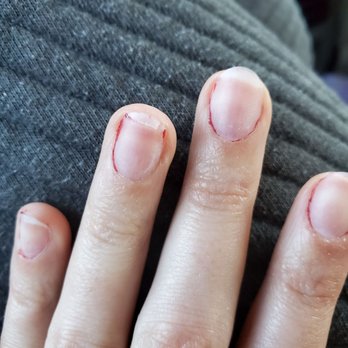 Kd Nails & Tanning - Broken nails from sanding - Nail Salons Near Me - Durham, North Carolina