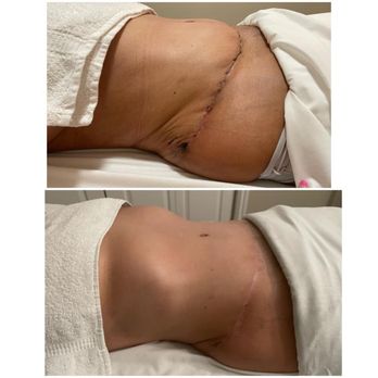 Escape Day Spa - Post Operation Lymphatic Drainage - Massage Near Me - Playa Vista, California Escape Day Spa - Post Operation Lymphatic Drainage - Massage Near Me - Playa Vista, California