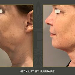 Parfaire Medical Aesthetics
