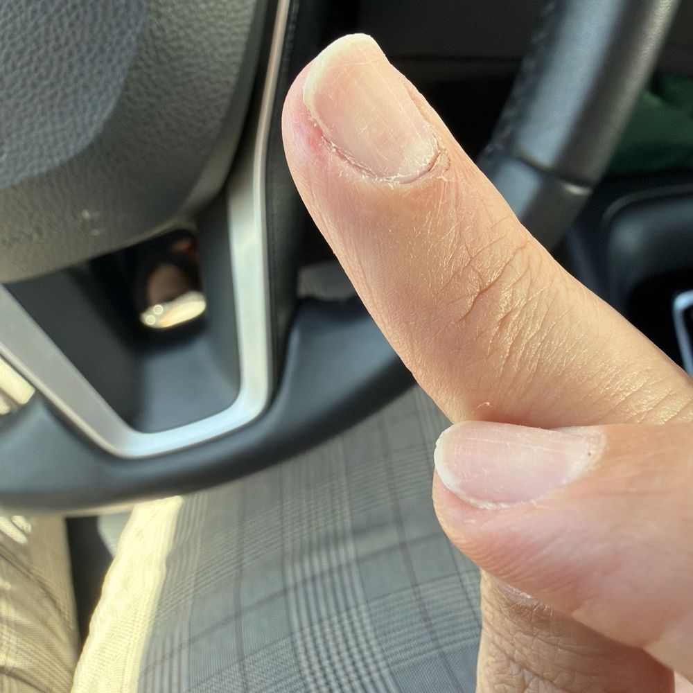 Golden Nails - Trimmed to much the side of my finger and left it tender to touch - Nail Salons Near Me - Lancaster, California