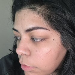 2 days after and it's healing up perfectly!