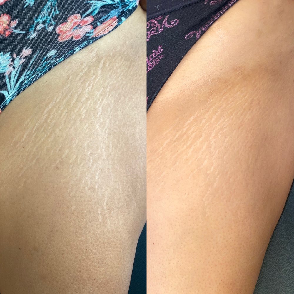 Hallowed Health and Skin Logo