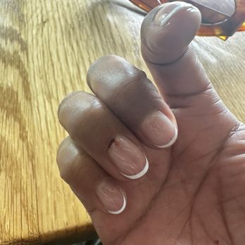 DC Nail Spa - 1 hour after my service. Nail cuticle is still actively bleeding. - Nail Salons Near Me - Washington, DC, District of Columbia DC Nail Spa - 1 hour after my service. Nail cuticle is still actively bleeding. - Nail Salons Near Me - Washington, DC, District of Columbia