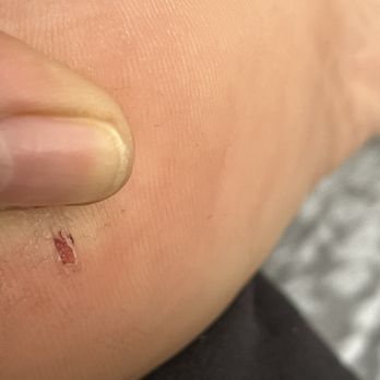 Lakeview at Superstition Springs - The nail literally sliced my heel open because it was hammered in at an angle, lazy work that YOU WILL BE CHARGED FOR IF THEY CAN FIND A WAY - Apartments Near Me - Mesa, Arizona Lakeview at Superstition Springs - The nail literally sliced my heel open because it was hammered in at an angle, lazy work that YOU WILL BE CHARGED FOR IF THEY CAN FIND A WAY - Apartments Near Me - Mesa, Arizona