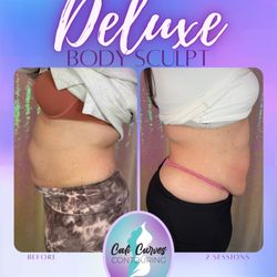 Cali Curves Contouring