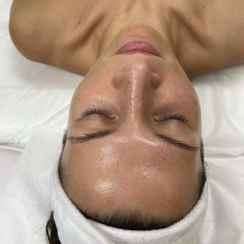 Jade Spa - Comparison of skin care effects in real photos -Before skin care - Cosmetics & Beauty Supply Near Me - Palm Beach Gardens, Florida Jade Spa - Comparison of skin care effects in real photos -Before skin care - Cosmetics & Beauty Supply Near Me - Palm Beach Gardens, Florida