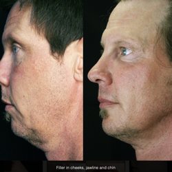 Ageless Advanced Aesthetics