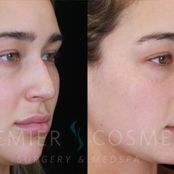 Premier Cosmetic Surgery & MedSpa