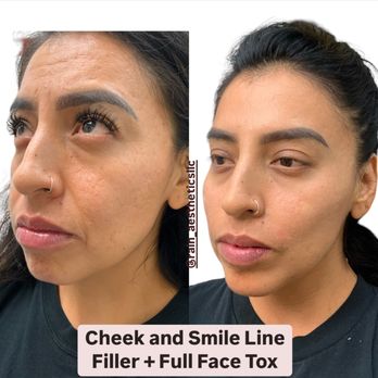 Rain Aesthetics Medspa - Weight Loss Centers Near Me - Glendale, Arizona Rain Aesthetics Medspa - Weight Loss Centers Near Me - Glendale, Arizona
