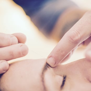 True Nature Wellness - Acupuncture eases stress and has excellent results with issues like insomnia, anxiety and depression. - Acupuncture Near Me - Sebastopol, California True Nature Wellness - Acupuncture eases stress and has excellent results with issues like insomnia, anxiety and depression. - Acupuncture Near Me - Sebastopol, California