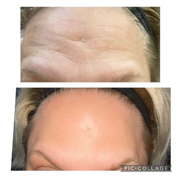 Plush Botox Bar - Botox by Dr. Griffin - Medical Spas Near Me - Portland, Oregon Plush Botox Bar - Botox by Dr. Griffin - Medical Spas Near Me - Portland, Oregon