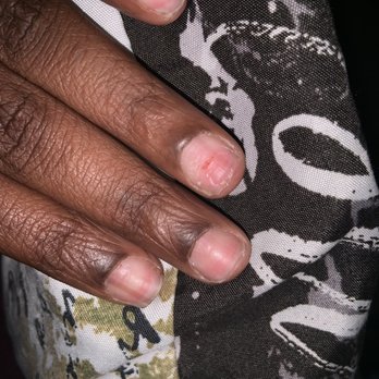 Lee Nails - 2 days now and it's still sore . Look how they filed my nails ... never again I swear - Nail Salons Near Me - Fort Lauderdale, Florida