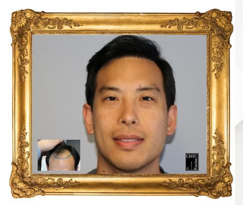 Chicago Hair Transplant Clinic