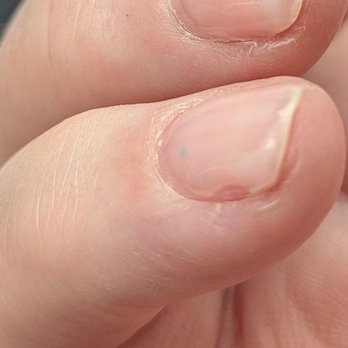 Blooming Nails - Missing and bulging gel. - Nail Technicians Near Me - Burlingame, California