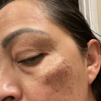 SKT Med Spa - Skin Care Near Me - San Clemente, California SKT Med Spa - Skin Care Near Me - San Clemente, California