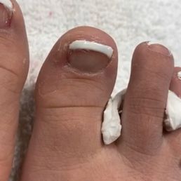 You can see the toe nail polish all over my toe.