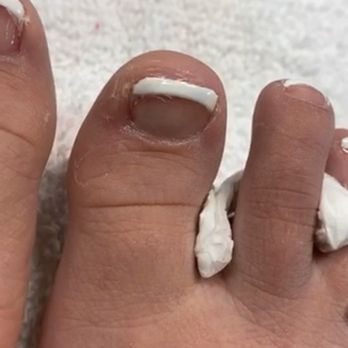 Nail Bliss - You can see the toe nail polish all over my toe. - Nail Salons Near Me - Goodlettsville, Tennessee