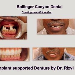 San Ramon Dentist - Bollinger Canyon Dental