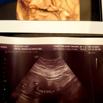Tummy Time - Diagnostic Imaging Near Me - Salida, California Tummy Time - Diagnostic Imaging Near Me - Salida, California