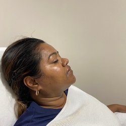 Haus of Glo - Post Deluxe HydraFacial Treatment