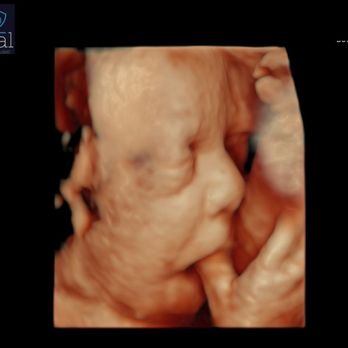 Reveal 3D/4D Ultrasound Studio - Ultrasound Imaging Centers Near Me - Gilbert, Arizona Reveal 3D/4D Ultrasound Studio - Ultrasound Imaging Centers Near Me - Gilbert, Arizona