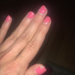 Peeling nail polish