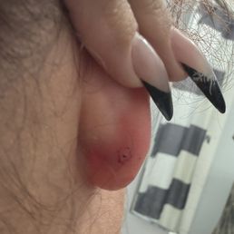 The back of the piercing directly after taking it out