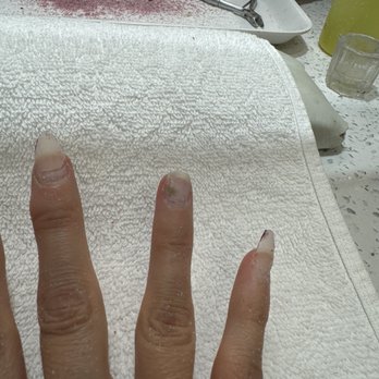 Glitter Box Nails Spa - A hand with damaged, uneven nails is placed on a textured white towel at a nail salon. The background shows nail tools, a tray, and salon supplies. - Skin Care Near Me - Mesa, Arizona