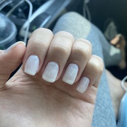 Ugly nails