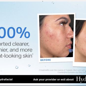 Dovian Haus - Book your Hydrafacial Today at Dovian Haus! - Waxing Near Me - Irvine, California Dovian Haus - Book your Hydrafacial Today at Dovian Haus! - Waxing Near Me - Irvine, California