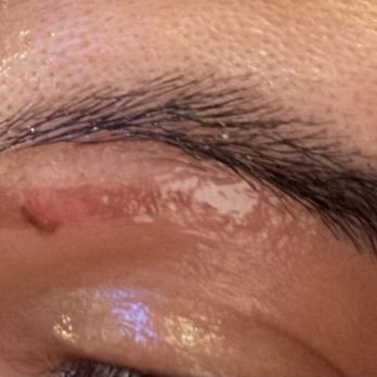 Aloha Nails and Spa - Lifted skin from eyebrow wax - Nail Salons Near Me - Denver, Colorado