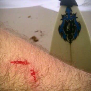 Haulover Park - Got bit by a mullet while surfing....loved it! - Beaches Near Me - Miami, Florida Haulover Park - Got bit by a mullet while surfing....loved it! - Beaches Near Me - Miami, Florida