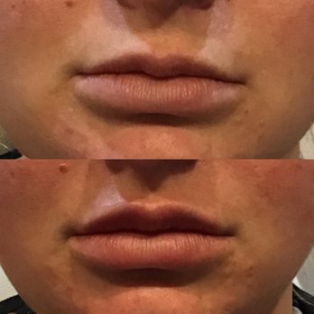 Dimensionz Injectables and Aesthetics - Medical Spas Near Me - Fort Collins, Colorado