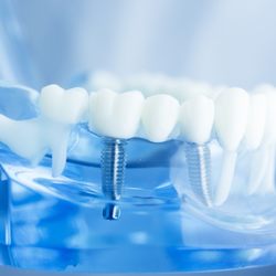 Associates In Dentistry
