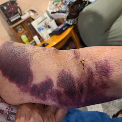 Aurora Charter Oak Behavioral Health Care - The same they hit me