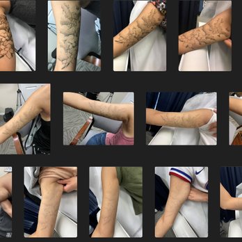 Shipers Laser Tattoo Removal Center - Tattoo Removal Near Me - Allen, Texas Shipers Laser Tattoo Removal Center - Tattoo Removal Near Me - Allen, Texas