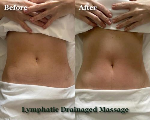 Lymphatic Drainage - We specialize in lymphatic drainage. Visible results! Call us today! Lymphatic Drainage - We specialize in lymphatic drainage. Visible results! Call us today!