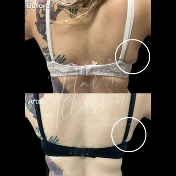 Total Illusion - Hair Removal Near Me - Seal Beach, California Total Illusion - Hair Removal Near Me - Seal Beach, California
