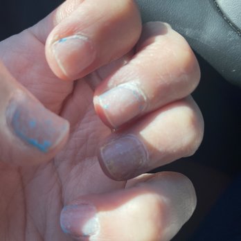 Sunshine Nails Spa - Bad nails because they never got back to me after the foils came off! - Nail Salons Near Me - Elk Grove, California Sunshine Nails Spa - Bad nails because they never got back to me after the foils came off! - Nail Salons Near Me - Elk Grove, California