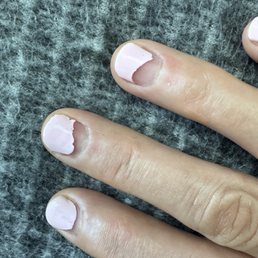 Look at my nails, they fell off in less than two weeks! Look at my nails, they fell off in less than two weeks!