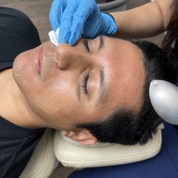 Charcoal Hollywood Facial